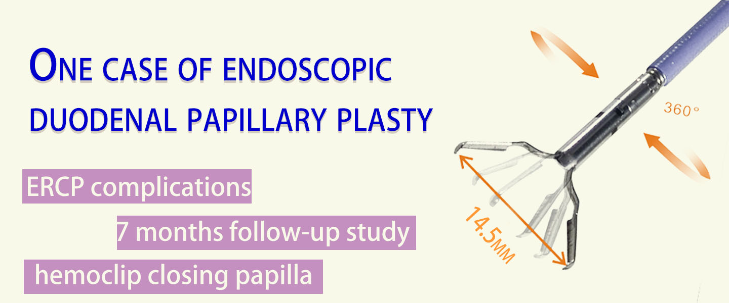 One case of endoscopic duodenal papillary plasty