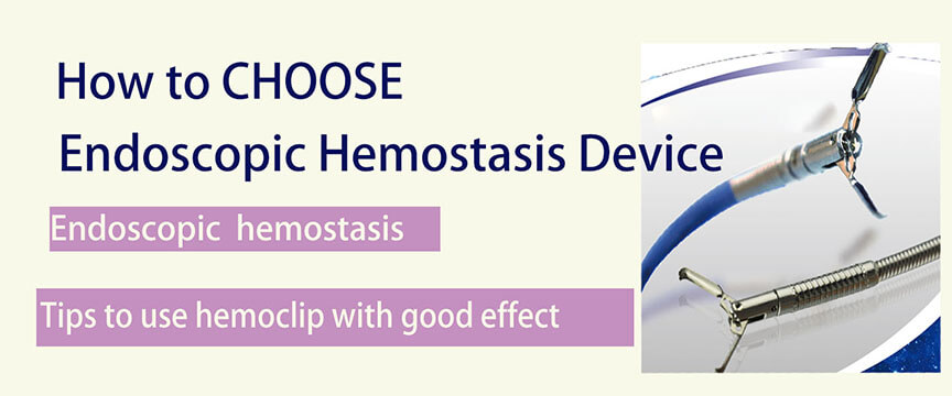 Endoscopic Hemostasis Device, How to CHOOSE