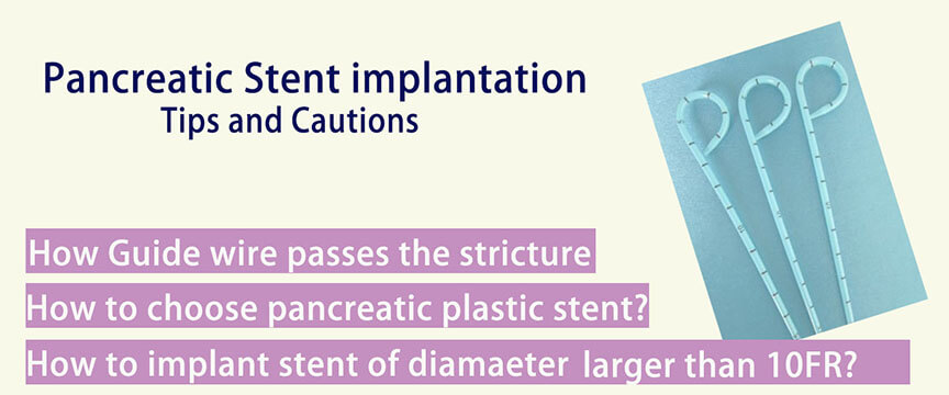 Tips and Cautions in Pancreatic Stent implantation