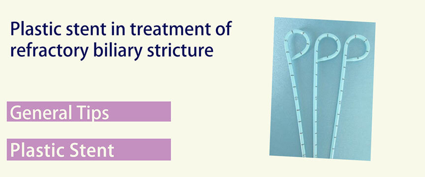 plastic stent in treatment of refractory biliary stricture