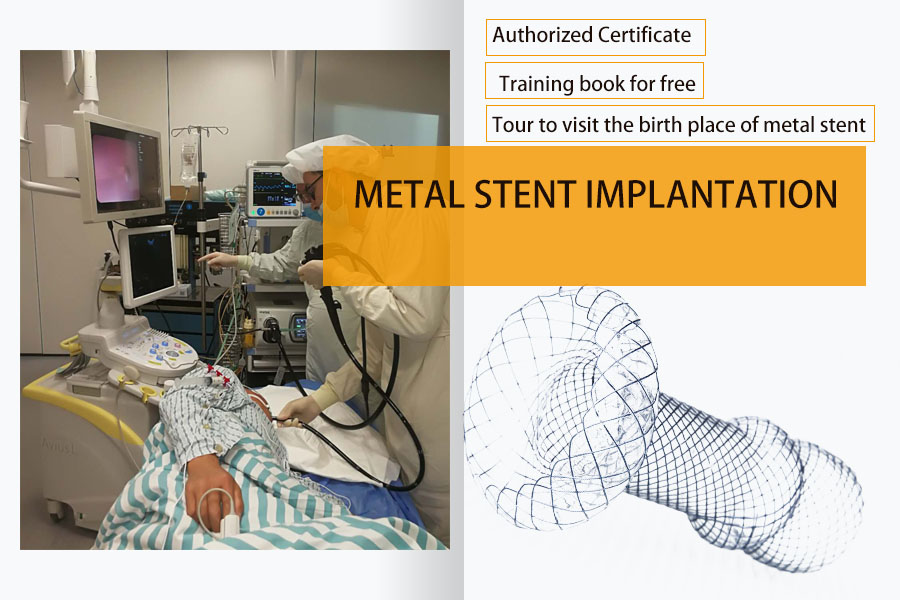 Gastrointestinal Metal Stent Implantation